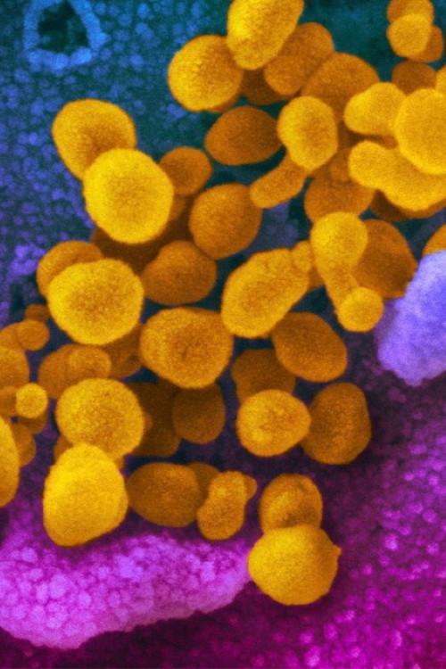 Did Covid Leak from a Lab in China? poster